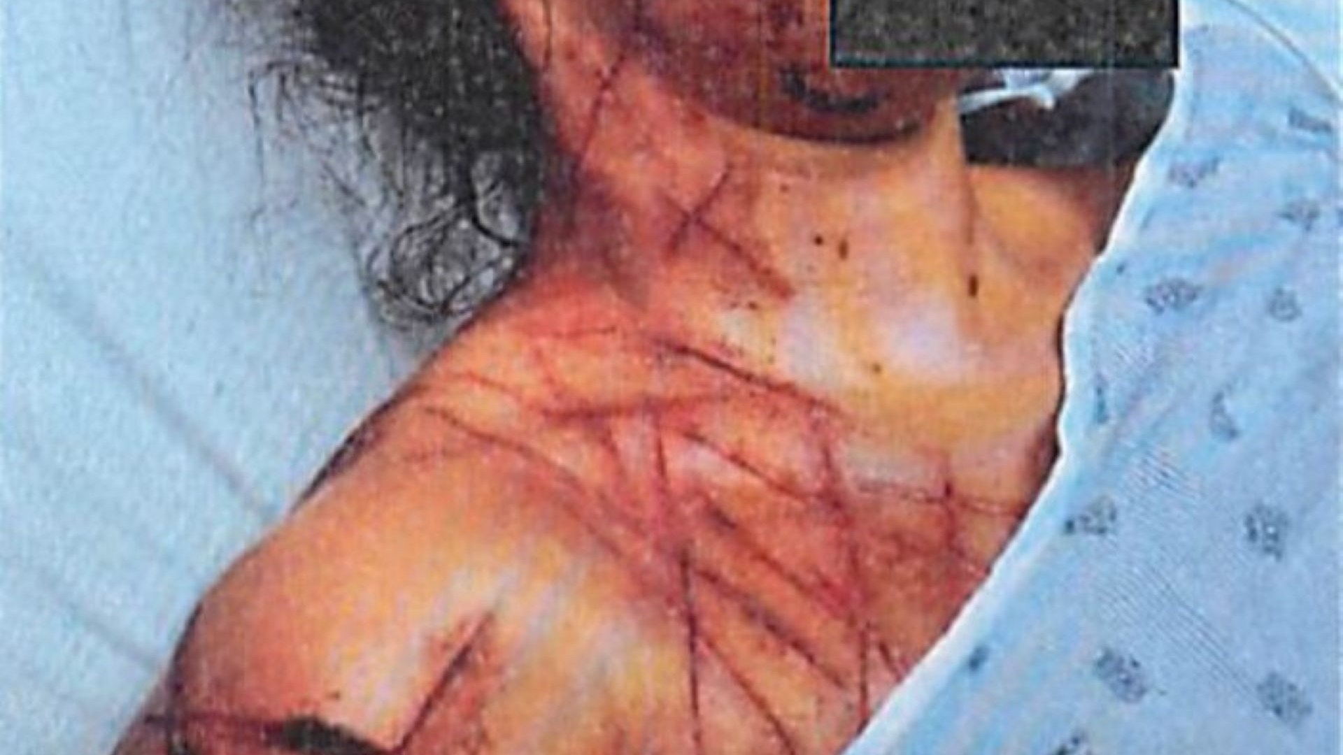 Ex-Republican staffer, 26, found hogtied & mutilated in ‘fake anti-Trump attack’ ordered to get mental health treatment